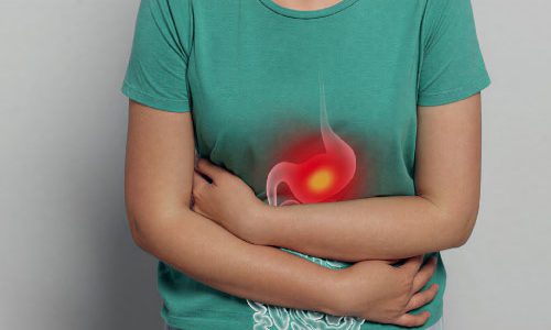 IBS-disease