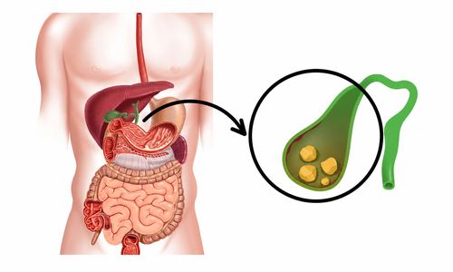 gallbladder